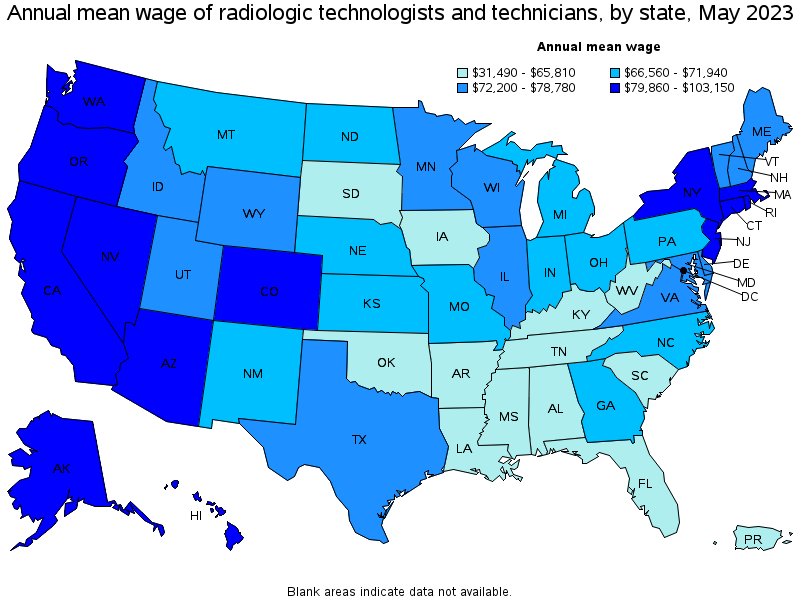 Radiology Tech: Job Outlook, Salary, Career Path, and  Much More...